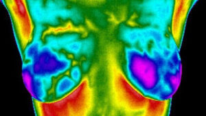 Thermographic image of a chest.