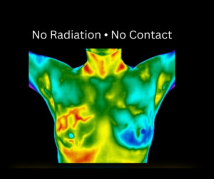 Heat map image of upper body.
